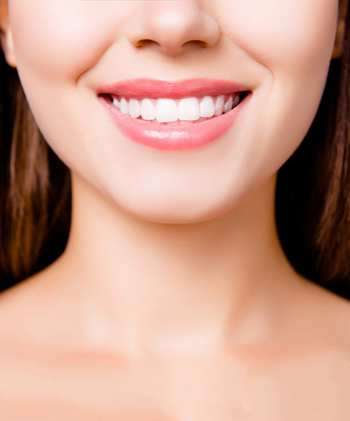 Porcelain veneers can beautify your smile.