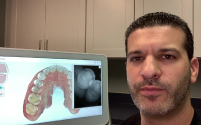 Digital Impressions: How the iTero Element 5D Scanner Enhances Modern Dentistry