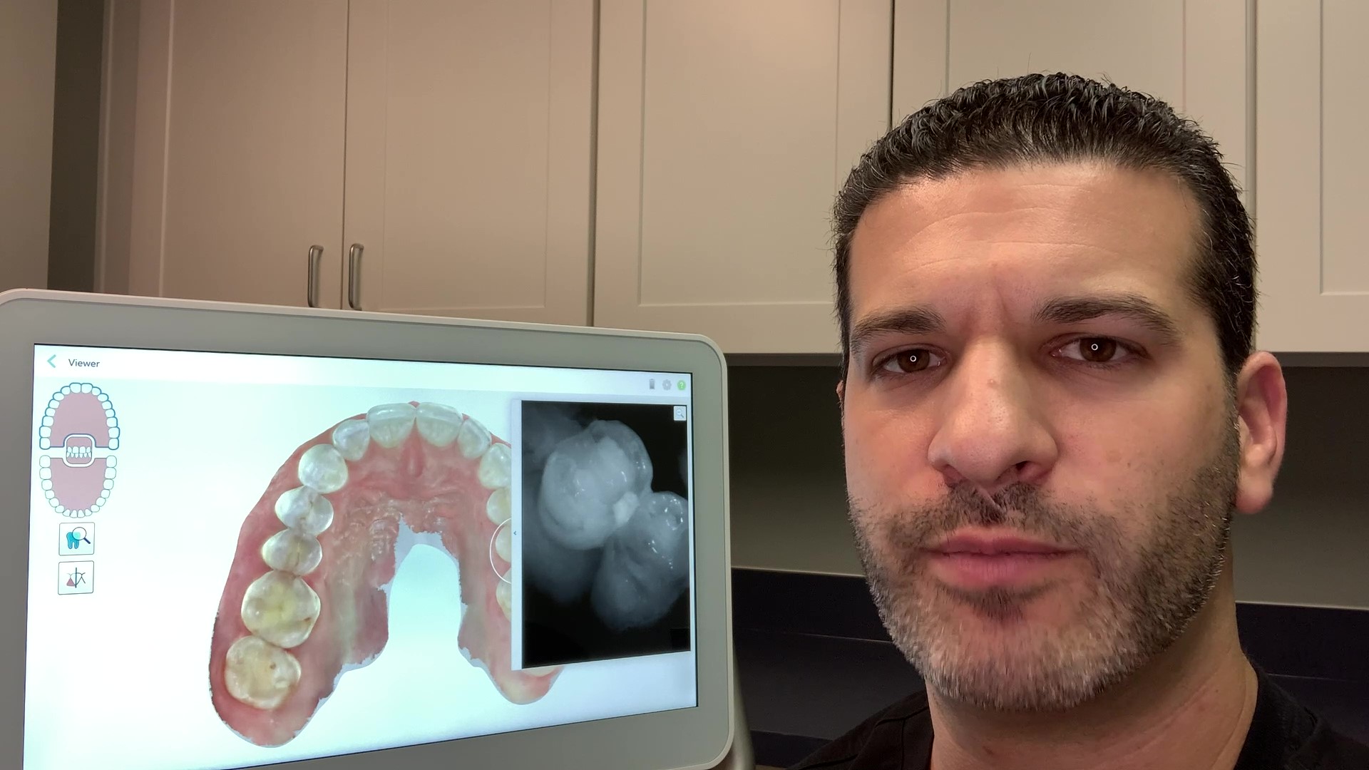 West Bloomfield dentist Adam Fienman, DDS, explains the benefits of digital impressions and digital X-rays using the iTero Element 5D Digital Scanner, which features an intraoral camera.