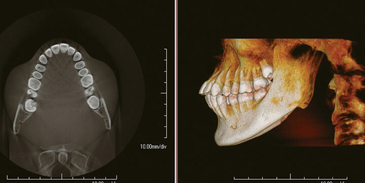 Images to represent CBCT 3D imaging technology are shown here.