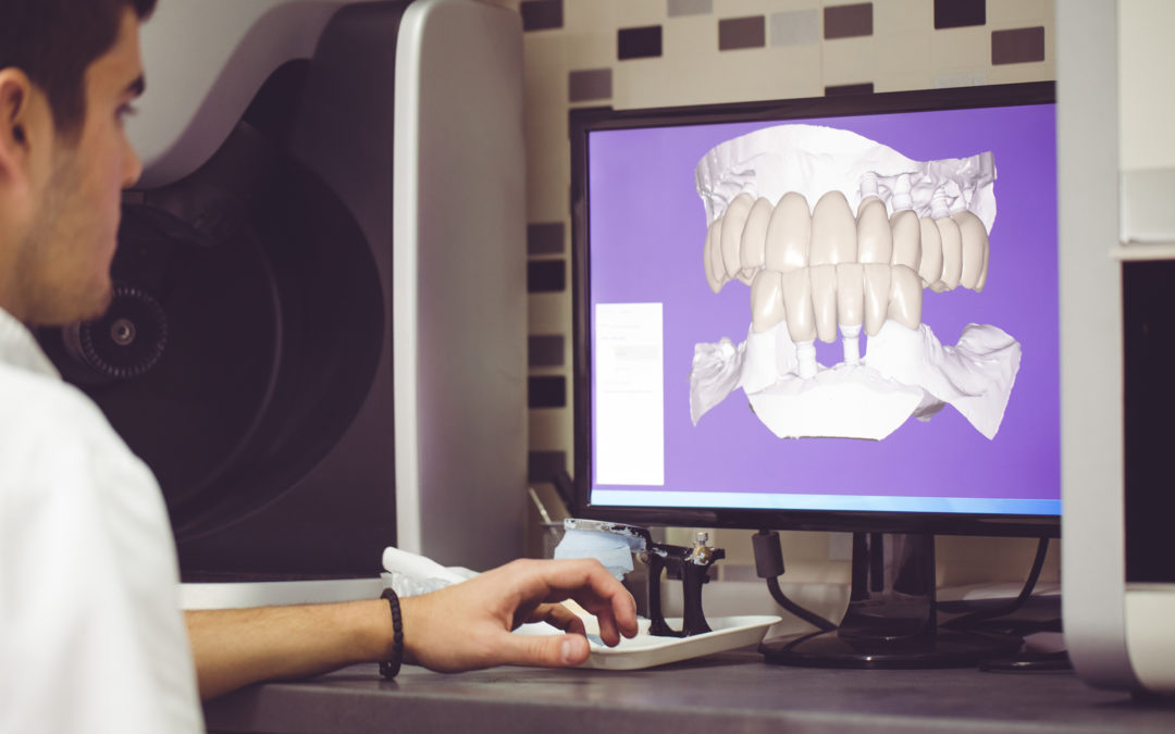 Guided implant surgery technology, represented here, provides dentists with a resource for optimal implant procedures.
