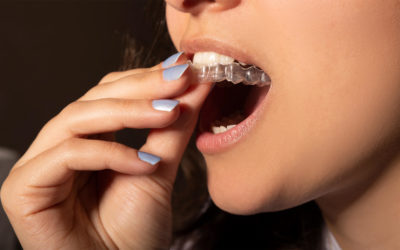 What Should I do if my Invisalign Doesn’t Fit?