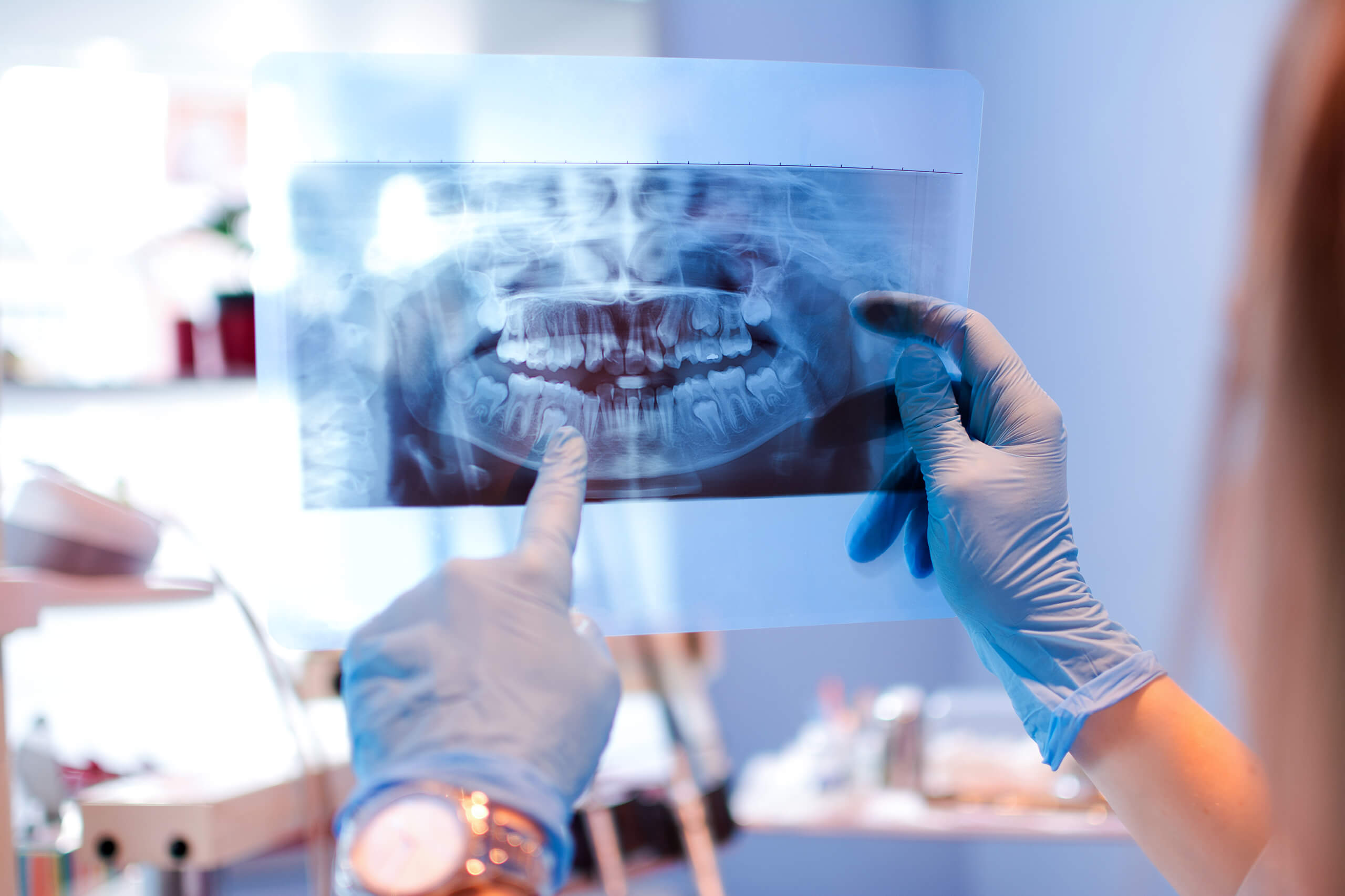 A dentist holds up a dental X-ray image. Despite minimal radiation, the benefits of dental X-rays outweigh the risks.