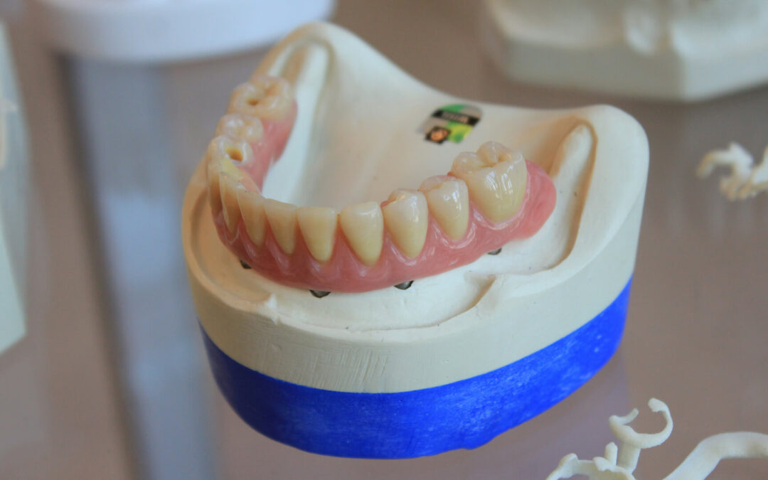 The Future of Dentures: Why Digital Dentures Are a Game-Changer