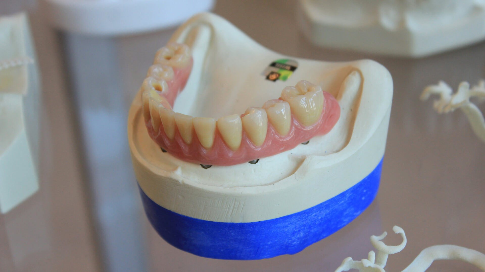 Dentures from West Bloomfield Cosmetic Dentistry, Dr. Fienman. Michigan's top dentist