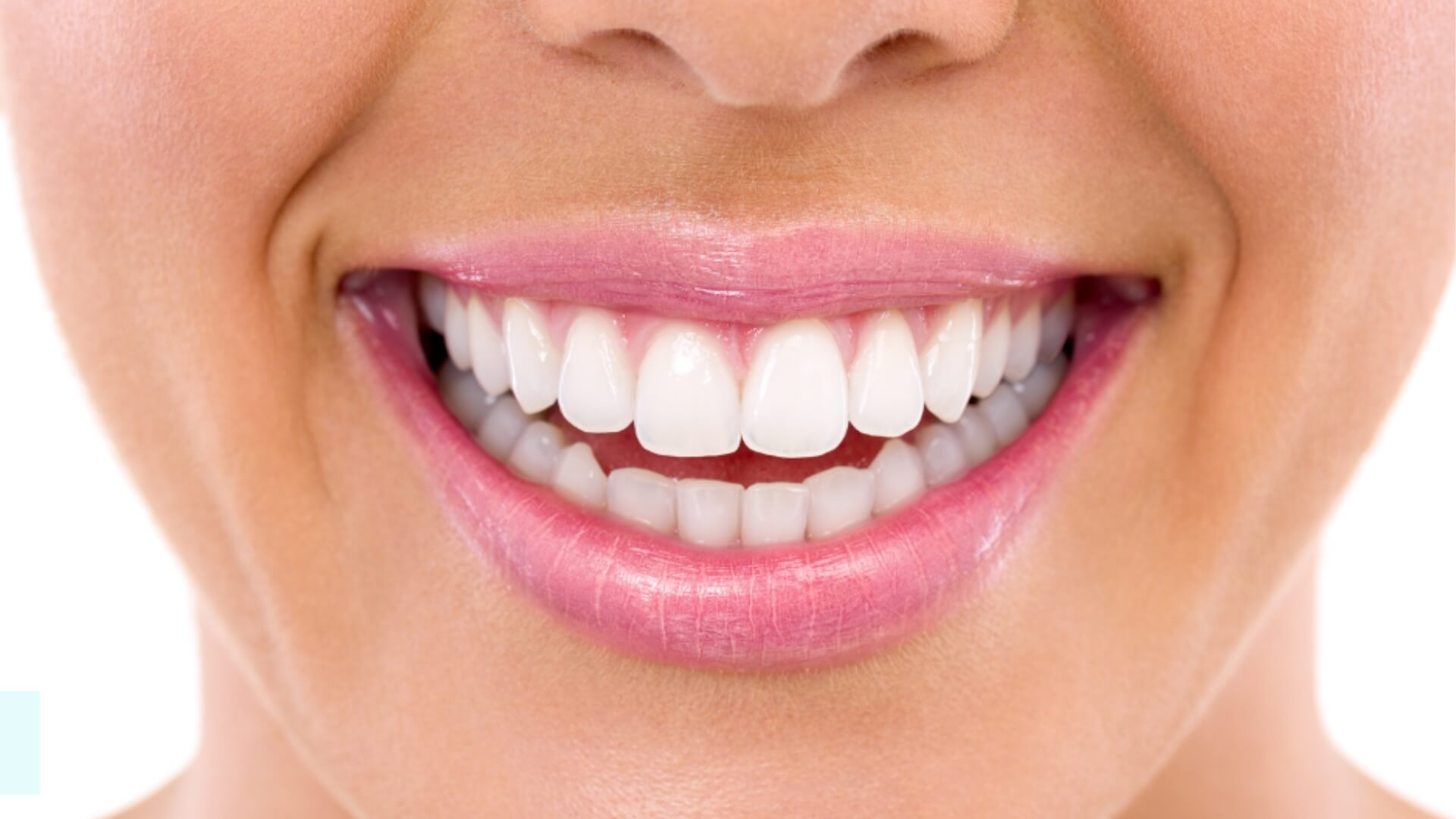 Teeth whitening myths debunked with a woman smiling after cheap teeth whitening in west bloomfield. Learn more with our before and after pics of teeth whitening.